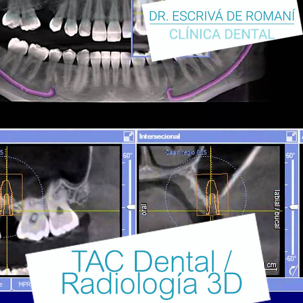 Radiología 3D y TAC Dental